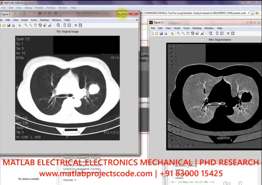 A Tool For Lung Nodules Analysis Based On Segmentation And Morphological Operation project thumbnail image