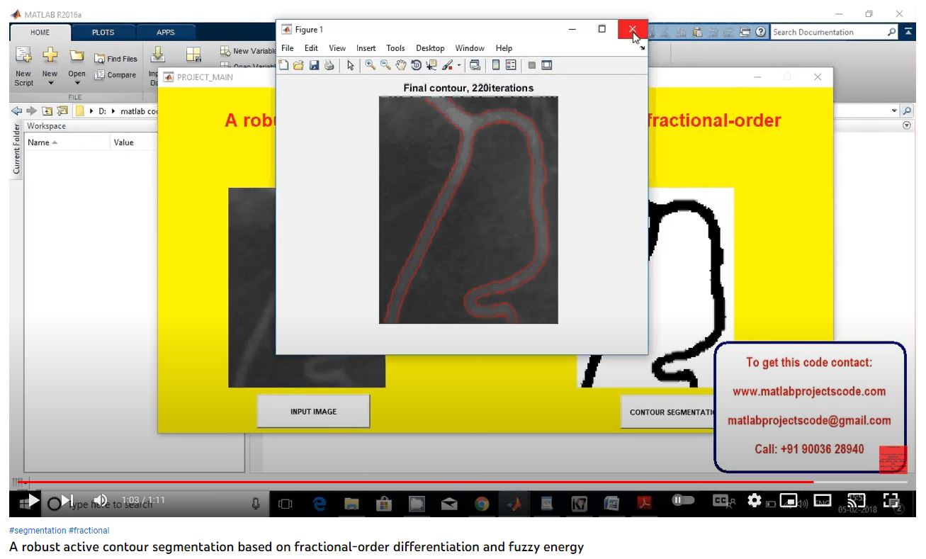 A Robust Active Contour Segmentation based on Fractional-Order Differentiation and Fuzzy Energy project thumbnail image