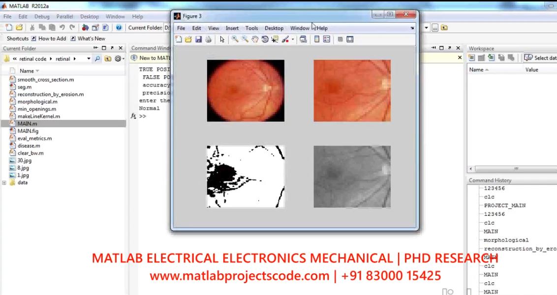 Analysis Of Retinal Blood Vesselsusing Image Processing Techniques project thumbnail image
