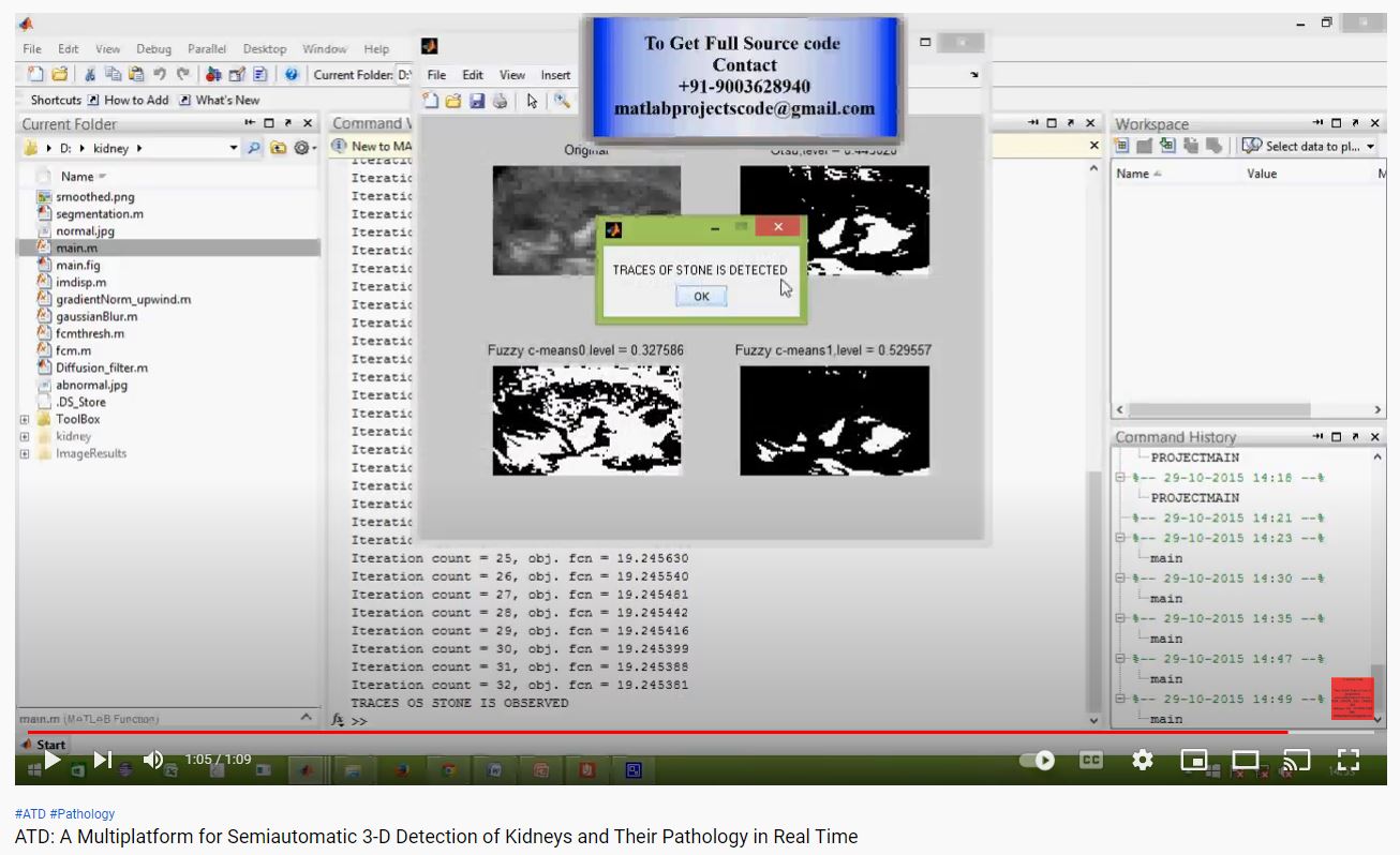 ATD_A Multiplatform for Semiautomatic 3-D Detection of Kidneys and Their Pathology in Real Time project thumbnail image