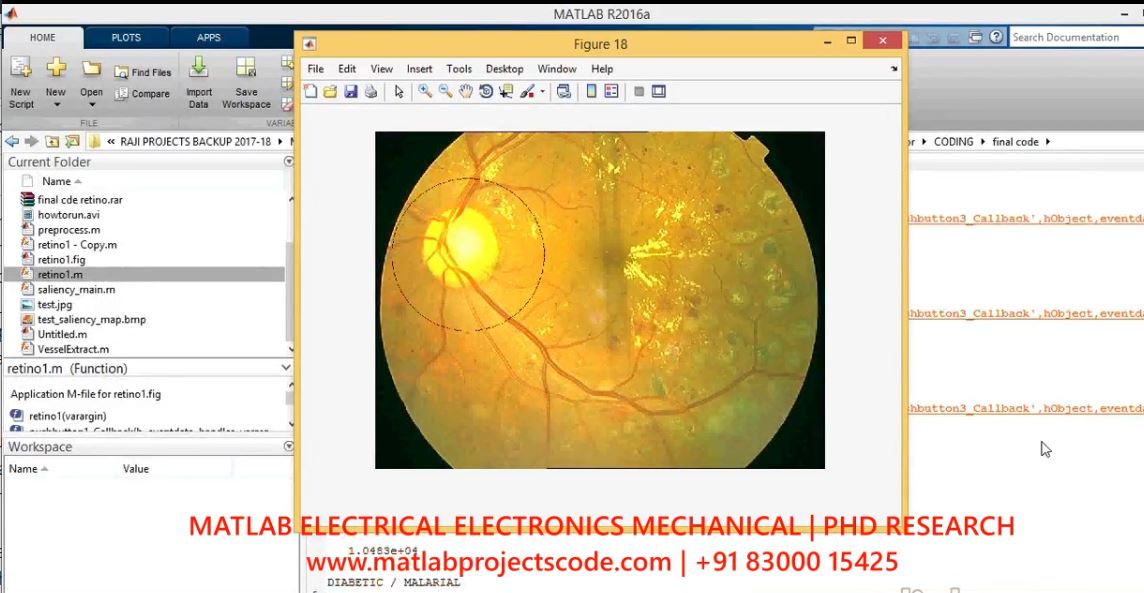 Automatic Detection Of Retinal Lesions Using Fuzzy Logic project thumbnail image