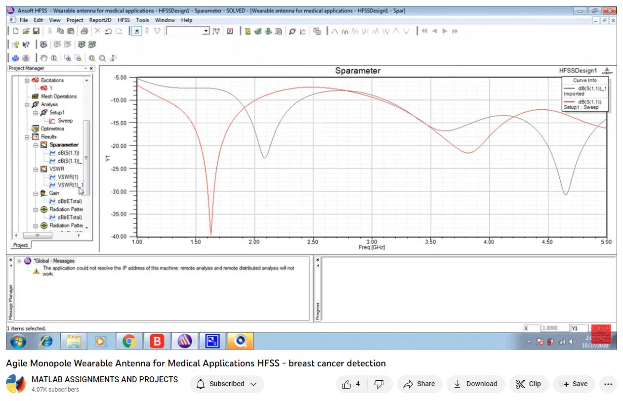 Agile Monopole Wearable Antenna For Medical Applications Hfss - Breast Cancer Detection-Matlab-Electrical Assignments-Projects-Phd Research project thumbnail image