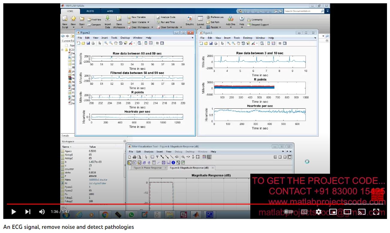 An Ecg Signal Remove Noise And Detect Pathologies project simulation thumbnail for Electrical Engineering