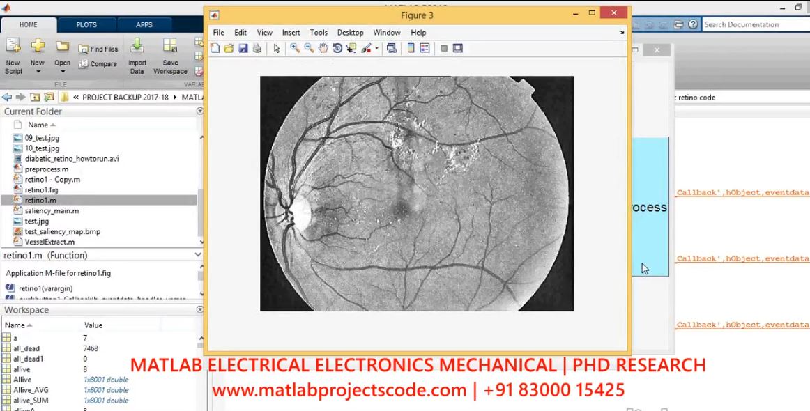 An Efficient Segmentation Of Macular Edema Using Clustering Algorithm project thumbnail image