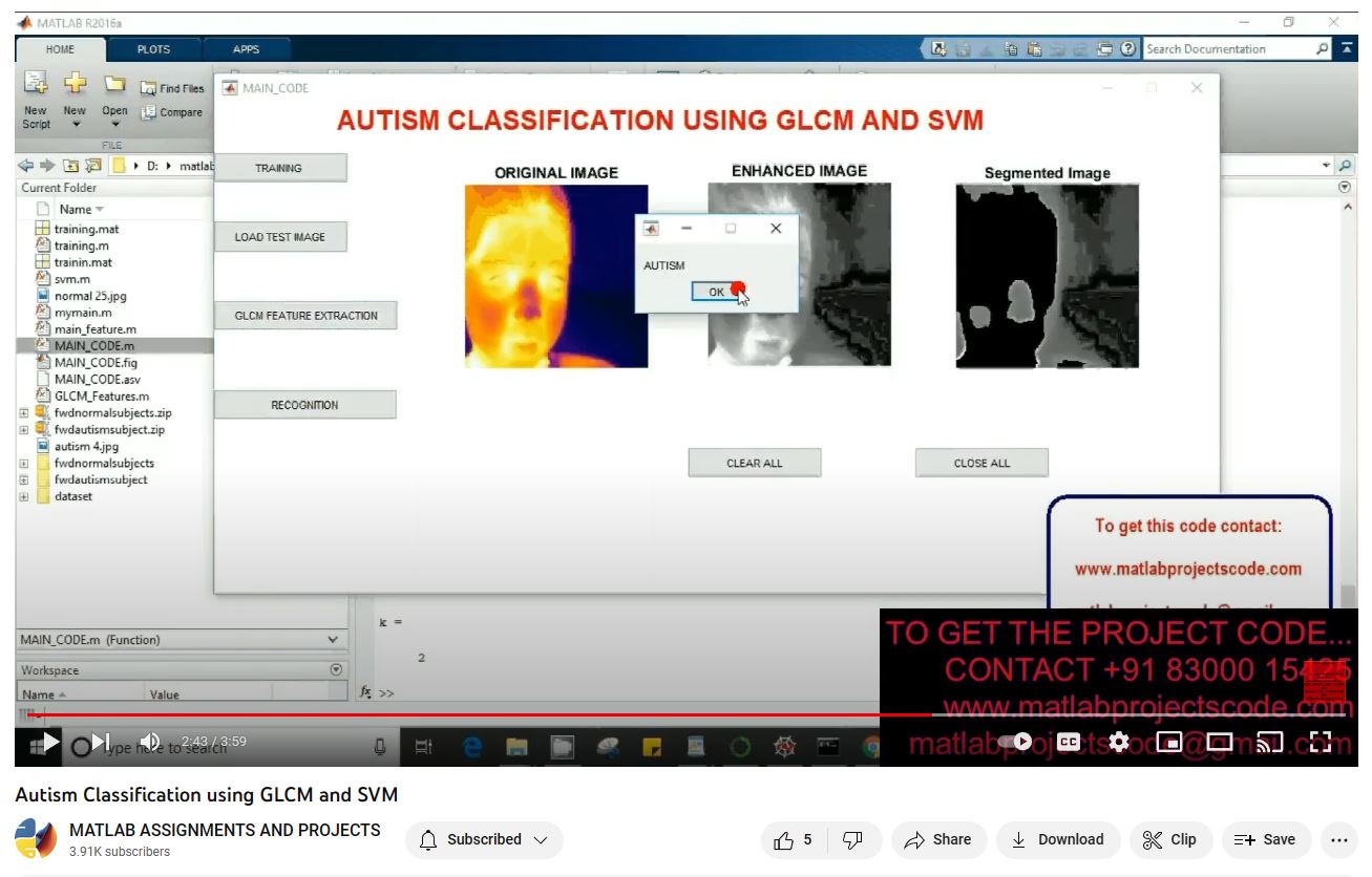 Autism Classification Using Glcm And Svm project thumbnail image