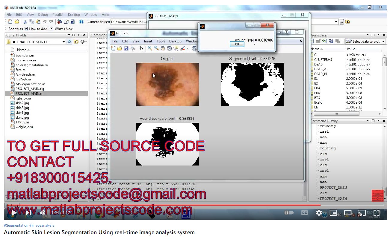 Automatic Skin Lesion Segmentation using Real-Time Image Analysis System project thumbnail image