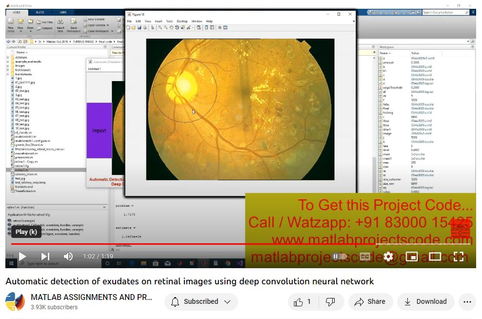 Automatic Detection Of Exudates On Retinal Images Using Deep Convolution Neural Network project thumbnail image