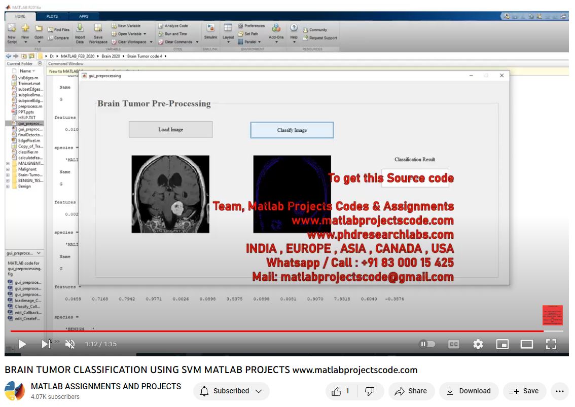 Brain Tumor Classification Using Svm Matlab Projects-Matlab Simulink-Electrical Assignments-Projects-Phd Research project thumbnail image