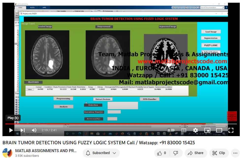 Brain Tumor Detection Using Fuzzy Logic System project thumbnail image