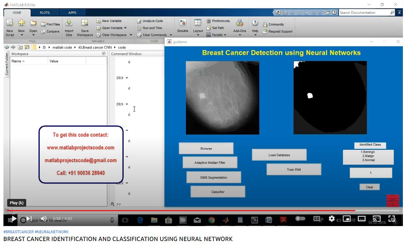 BREAST CANCER IDENTIFICATION AND CLASSIFICATION using NEURAL NETWORK project thumbnail image
