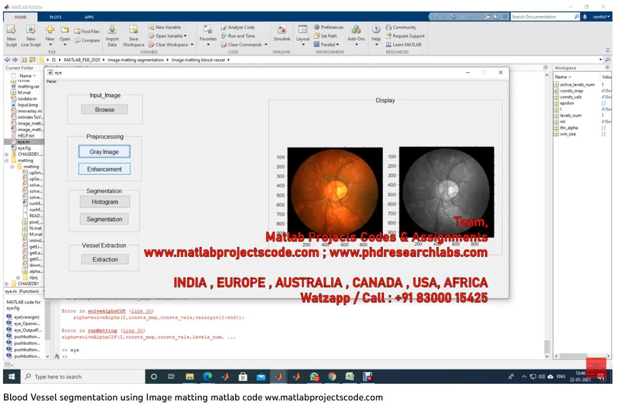 Blood Vessel Segmentation Using Image Matting Matlab Code project thumbnail image