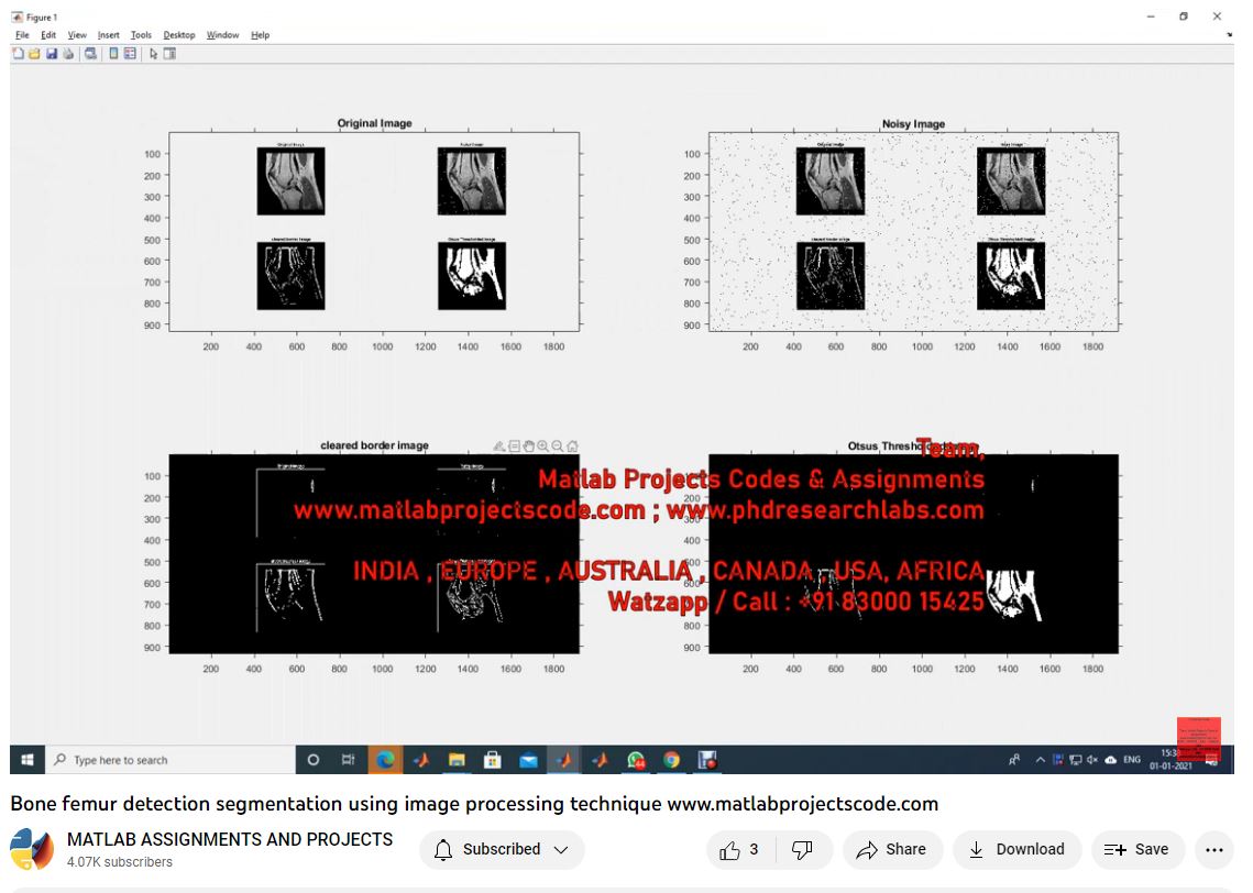 Bone Femur Detection Segmentation Using Image Processing Technique-Matlab Simulink-Electrical Assignments-Projects-Phd Research project thumbnail image