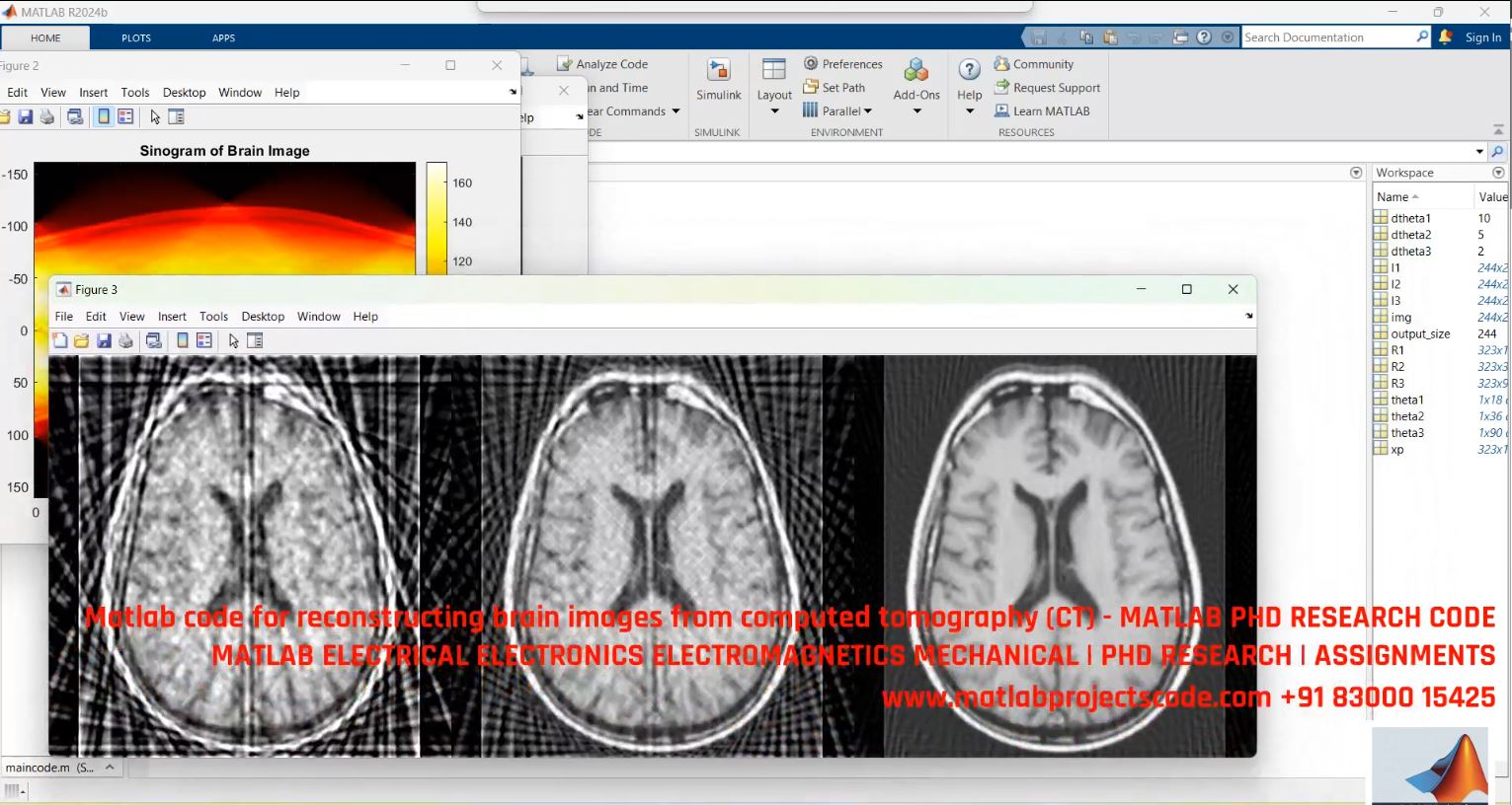Brain Image Reconstruction From Ct Scans - Matlab Code For Phd Medical Imaging Research project thumbnail image