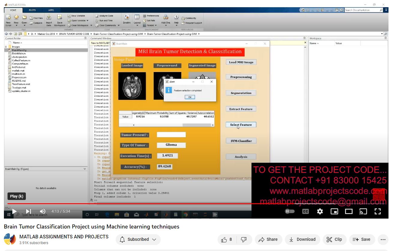 Brain Tumor Classification Project Using Machine Learning Techniques project thumbnail image