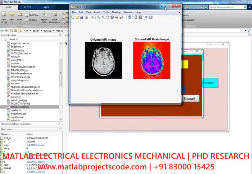 Brain Tumor Classification Using Edge Detection And Cnn project thumbnail image
