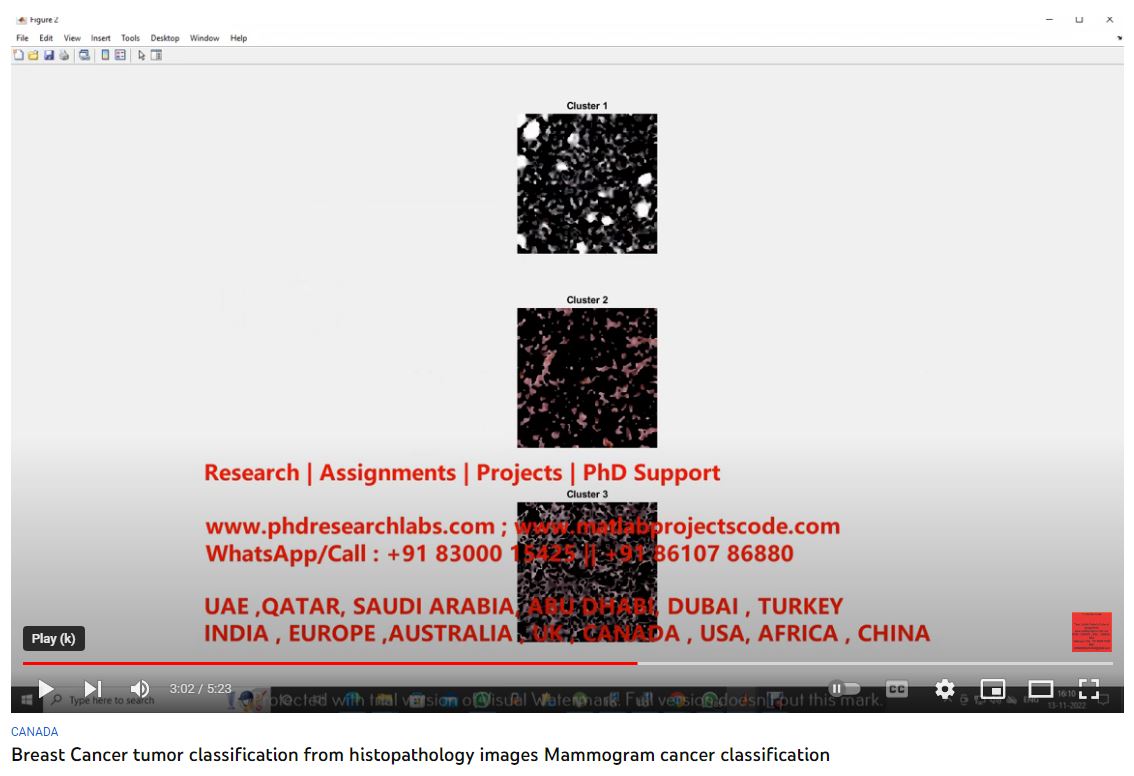Breast Cancer Tumor Classification from Histopathology Images - Mammogram Cancer Classification project thumbnail image