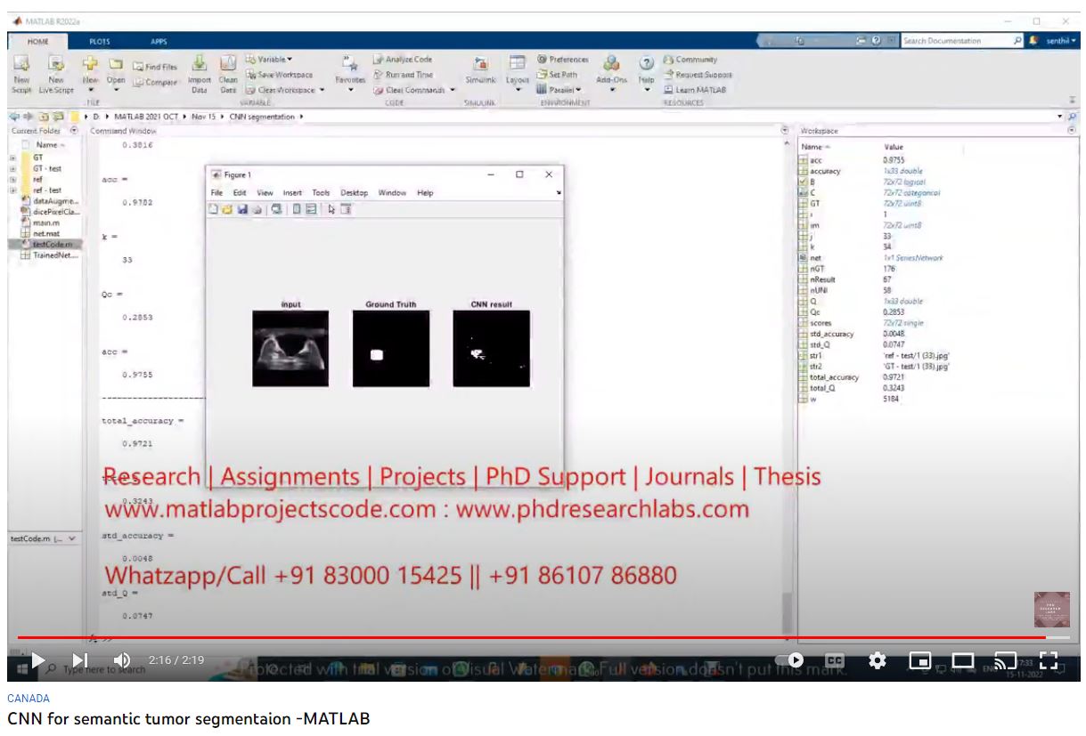 CNN for Semantic Tumor Segmentaion using MATLAB project thumbnail image