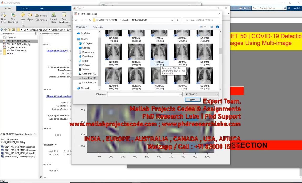 Covid-19 Detection _ Deep Learning project thumbnail image