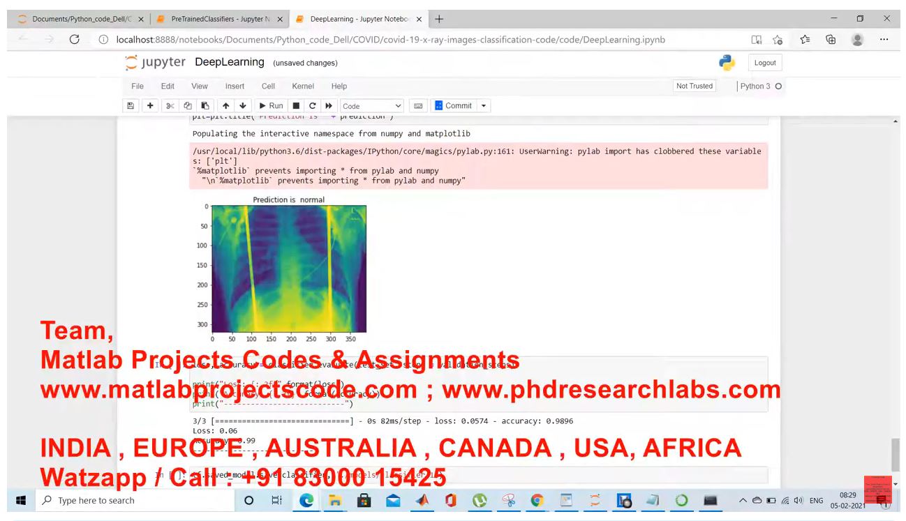 Covid-19-Xray-Image-Classification Ai Deep Learning Based Approaches To Predict - Python Code project thumbnail image