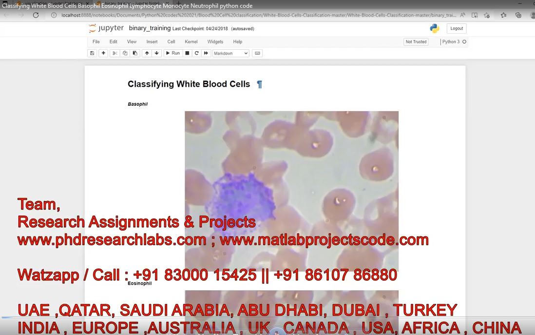 Classifying White Blood Cells Basophil Eosinophil Lymphocyte Monocyte Neutrophil Python Code project thumbnail image