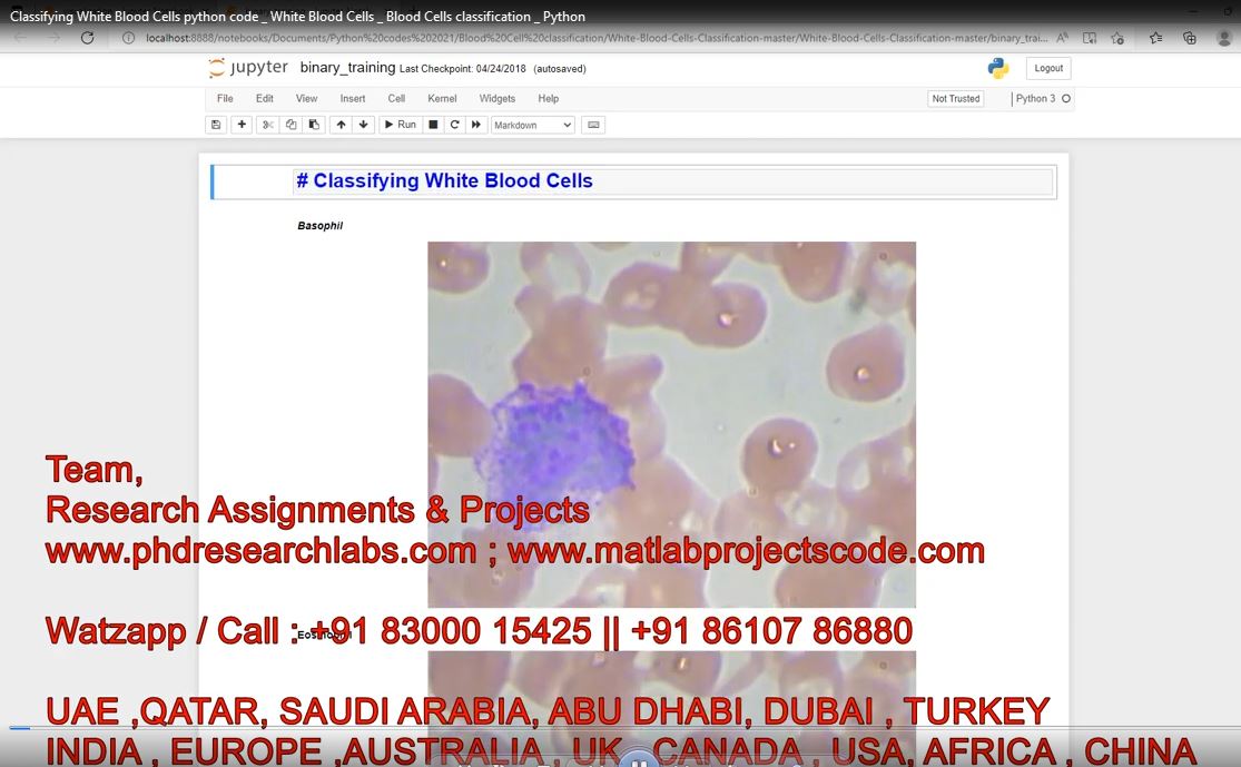 Classifying White Blood Cells Python Code _ White Blood Cells _ Blood Cells Classification _ Python project thumbnail image