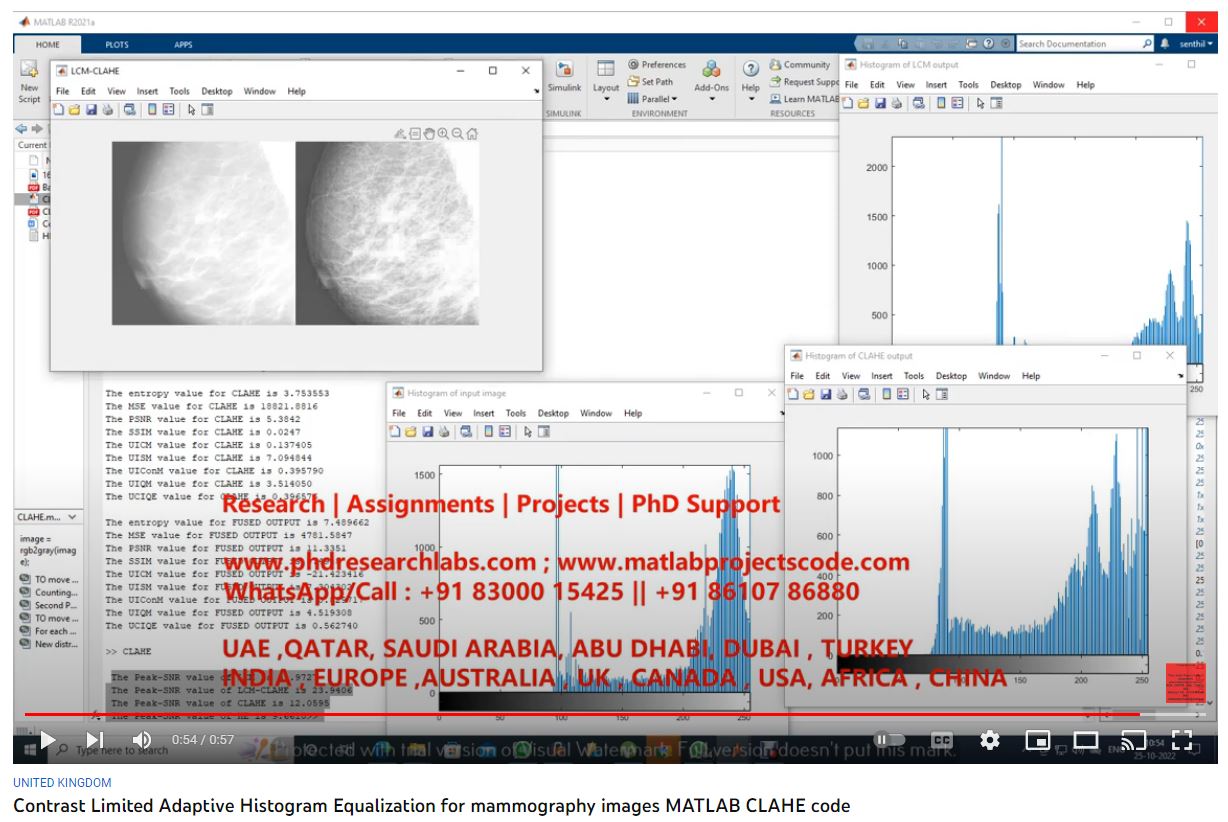 Contrast Limited Adaptive Histogram Equalization for Mammography Images Matllab CLAHE Code project thumbnail image