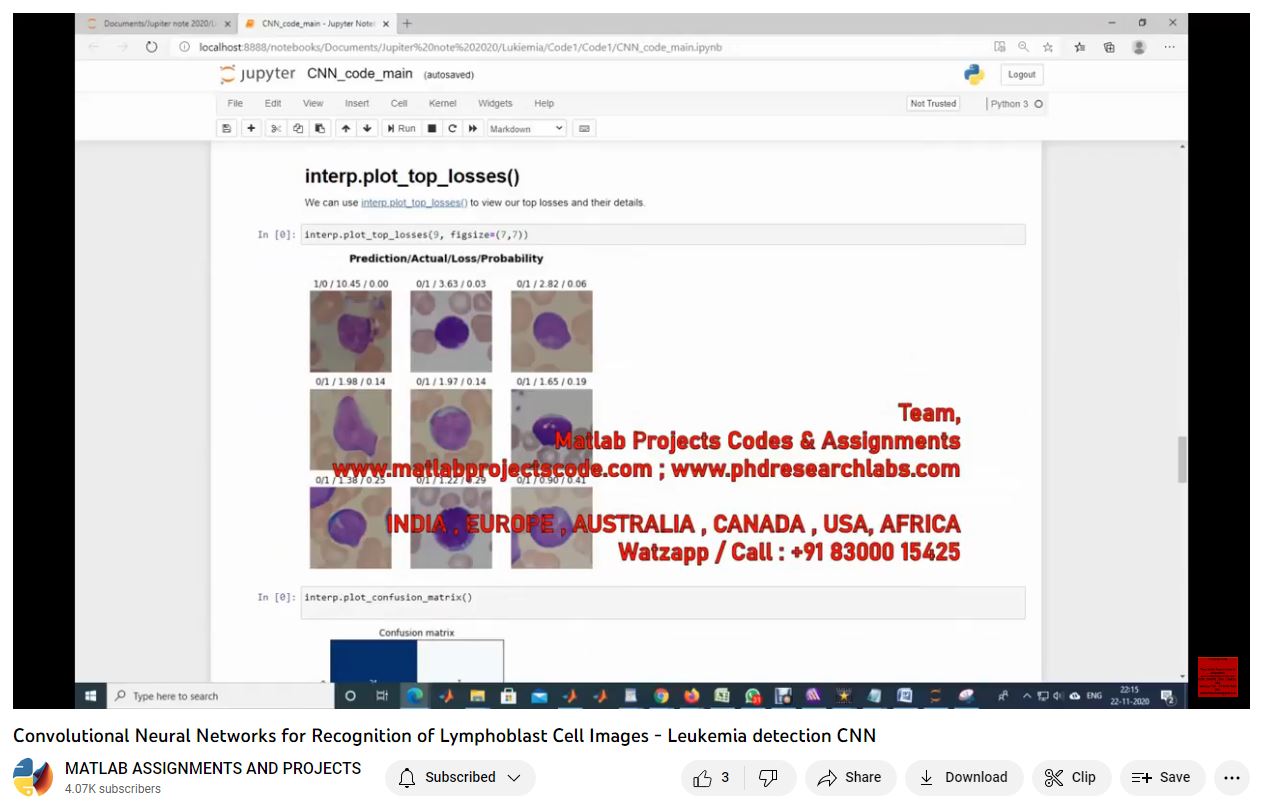 Convolutional Neural Networks For Recognition Of Lymphoblast Cell Images - Leukemia Detection Cnn-Matlab-Electrical Assignments-Projects-Phd Research project thumbnail image