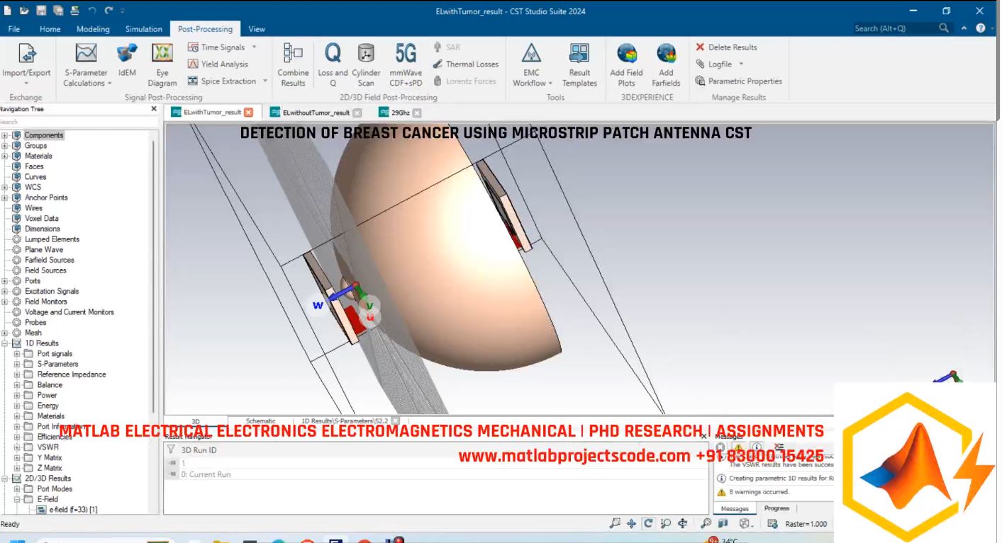Detection Of Breast Cancer Using Microstrip Patch Antenna Cst project thumbnail image