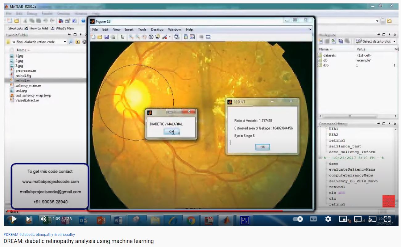 DREAM_diabetic Retinopathy Analysis using Machine Learning project thumbnail image