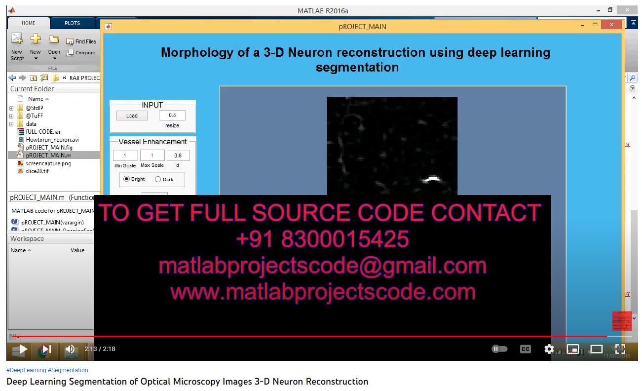 Deep Learning Segmentation of Optical Microscopy Images 3-D Neuron Reconstruction project thumbnail image
