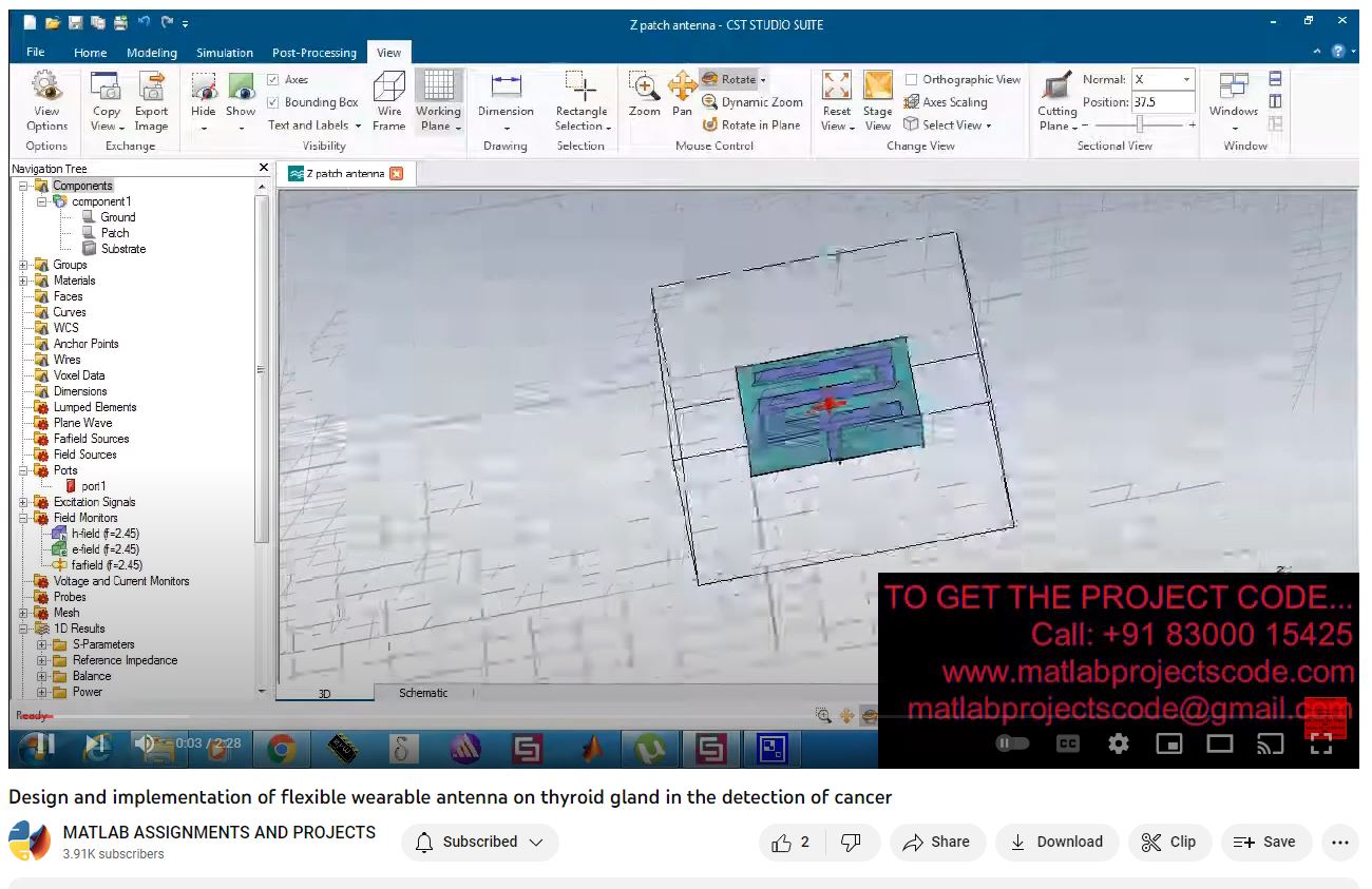 Design And Implementation Of Flexible Wearable Antenna On Thyroid Gland In The Detection Of Cancer project thumbnail image