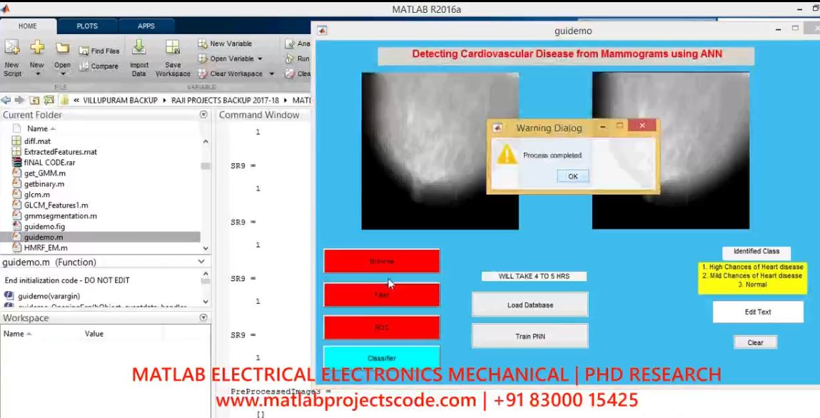Detecting Cardiovascular Disease From Mammograms With Deep Learning project thumbnail image