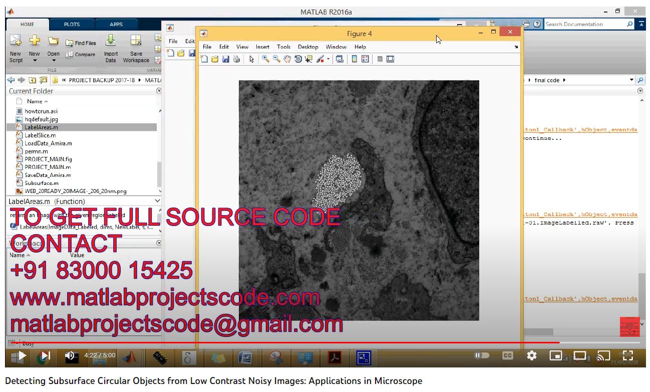 Detecting Subsurface Circular Objects from Low Contrast Noisy Images_ Applications in Microscope project thumbnail image