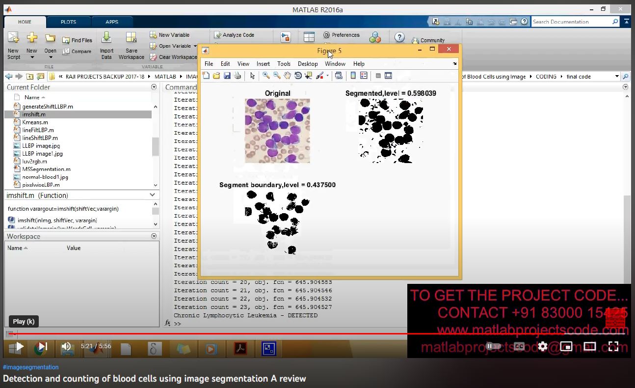 Detection and Counting of Blood Cells using Image Segmentation A Review project thumbnail image