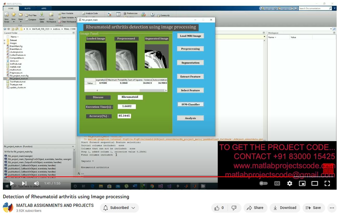 Detection Of Rheumatoid Arthritis Using Image Processing project thumbnail image