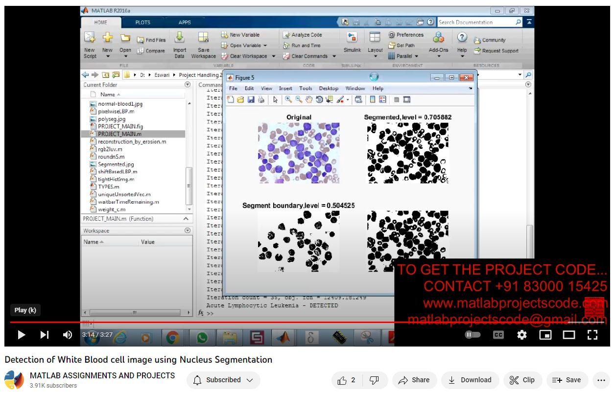 Detection Of White Blood Cell Image Using Nucleus Segmentation project thumbnail image