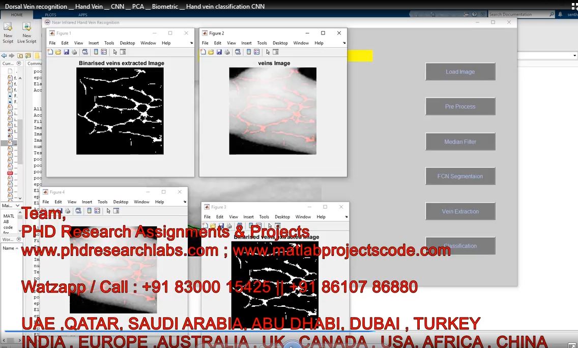 Dorsal Vein Recognition __ Hand Vein __ Cnn __ Pca __ Biometric __ Hand Vein Classification Cnn project thumbnail image