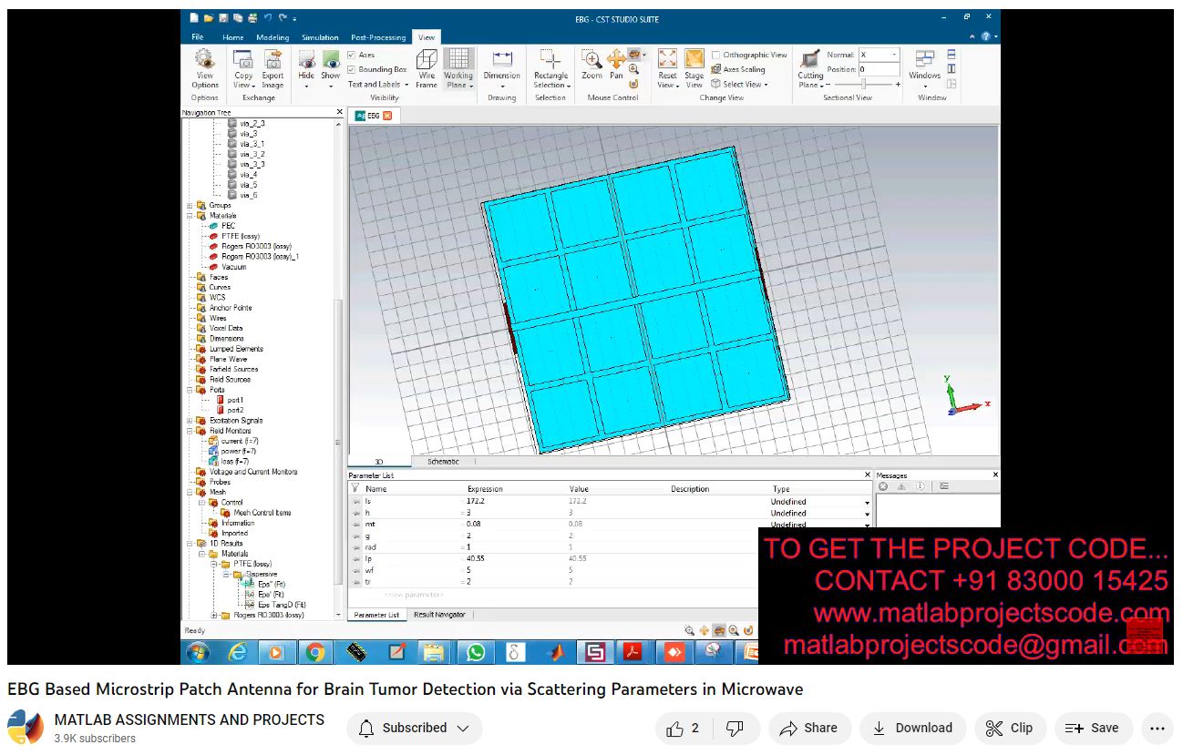 Ebg Based Microstrip Patch Antenna For Brain Tumor Detection Via Scattering Parameters In Microwave project thumbnail image