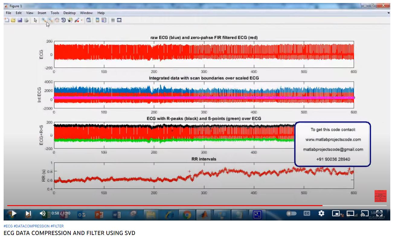 ECG DATA COMPRESSION AND FILTER using SVD project thumbnail image