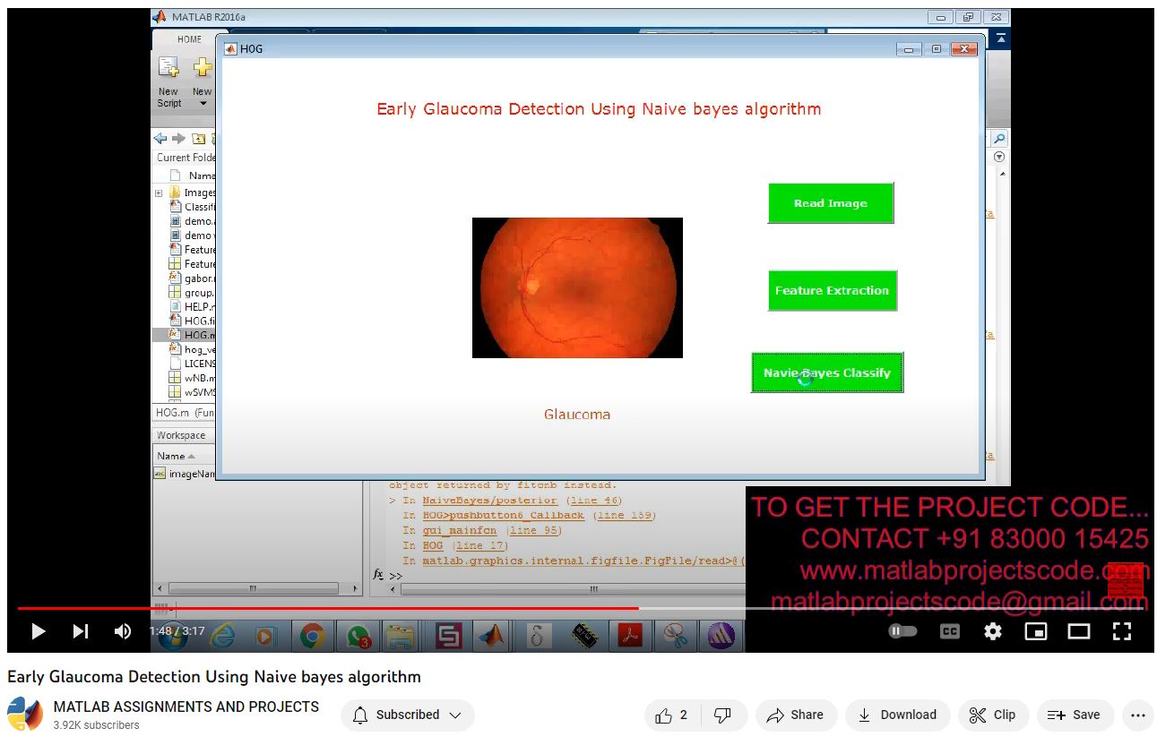 Early Glaucoma Detection Using Naive Bayes Algorithm project thumbnail image