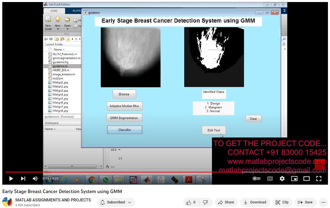 Early Stage Breast Cancer Detection System Using Gmm project thumbnail image