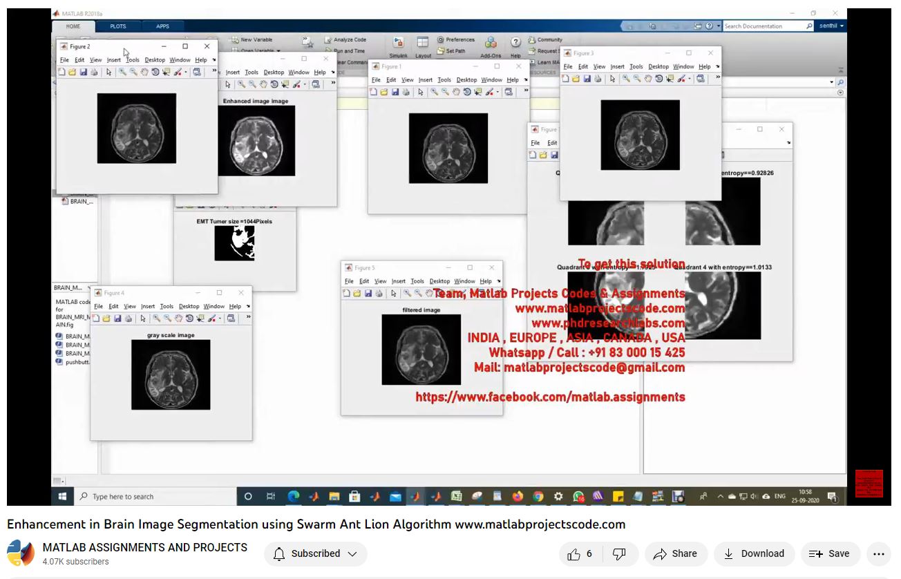 Enhancement In Brain Image Segmentation Using Swarm Ant Lion Algorithm-Matlab Simulink-Electrical Assignments-Projects-Phd Research project thumbnail image