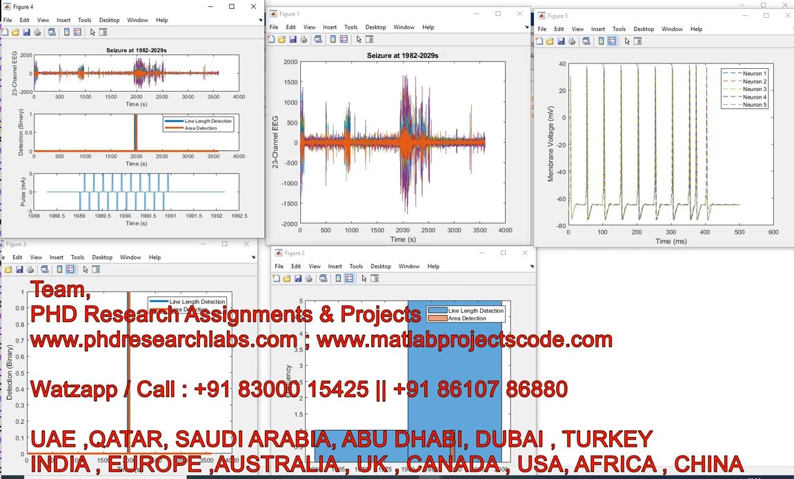 Epilepsy Seizure Detection Using Eeg And Ecg __ Matlab __ Epilepsy Seizure __ Eeg __ Seizure project thumbnail image
