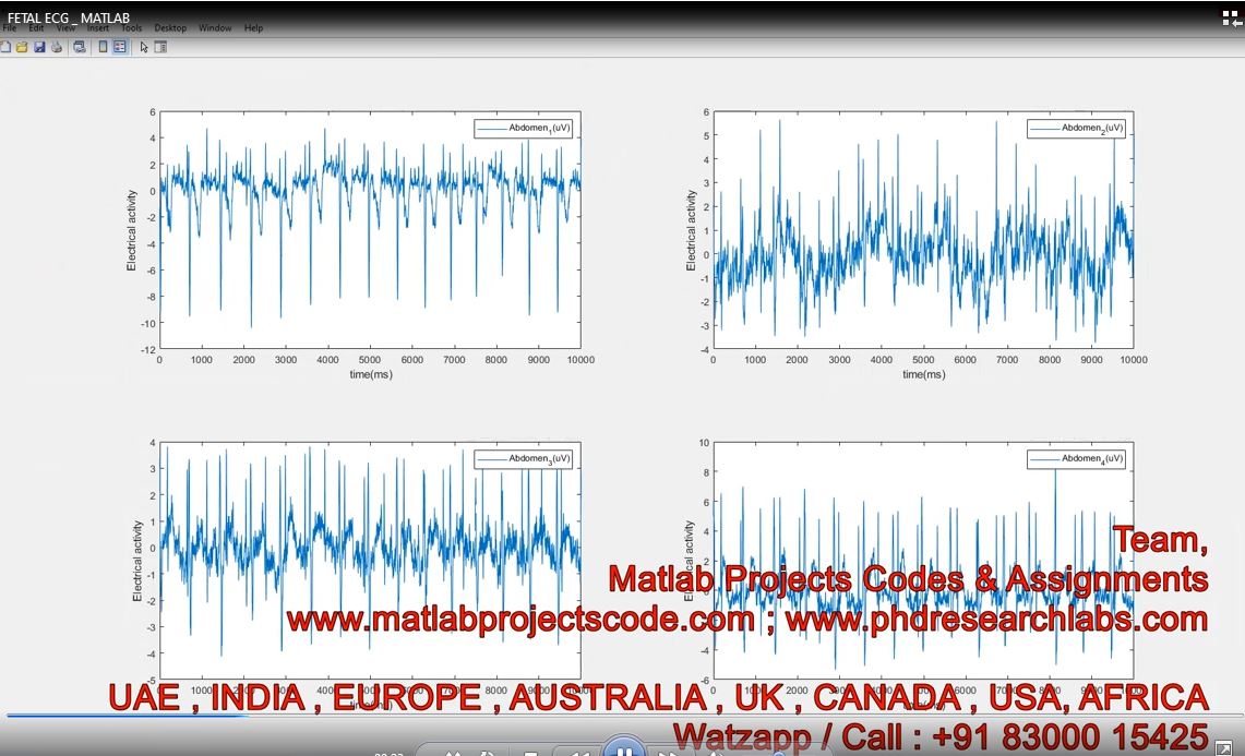 Fetal Ecg _ Matlab project thumbnail image