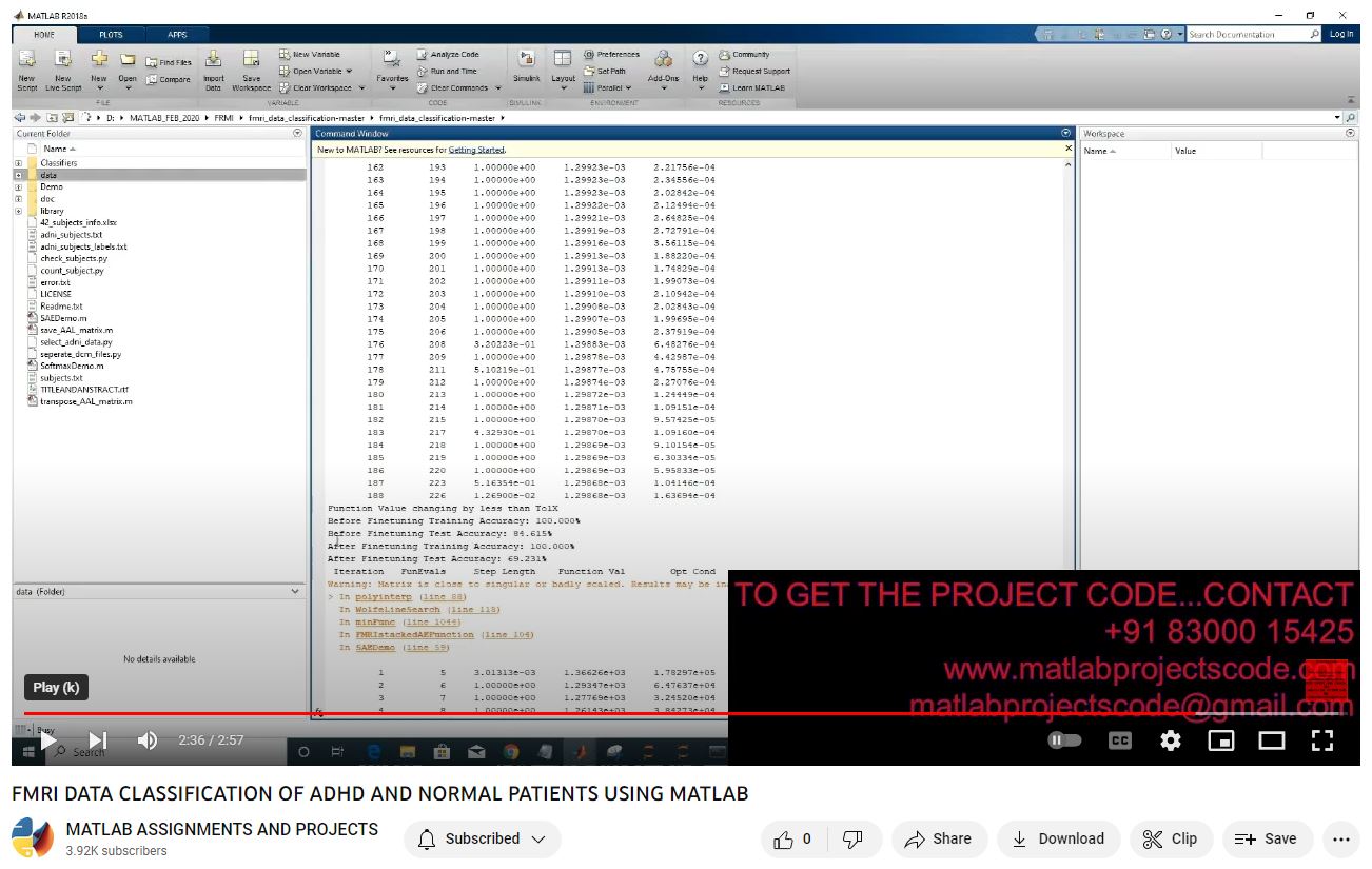 Fmri Data Classification Of Adhd And Normal Patients Using Matlab project thumbnail image