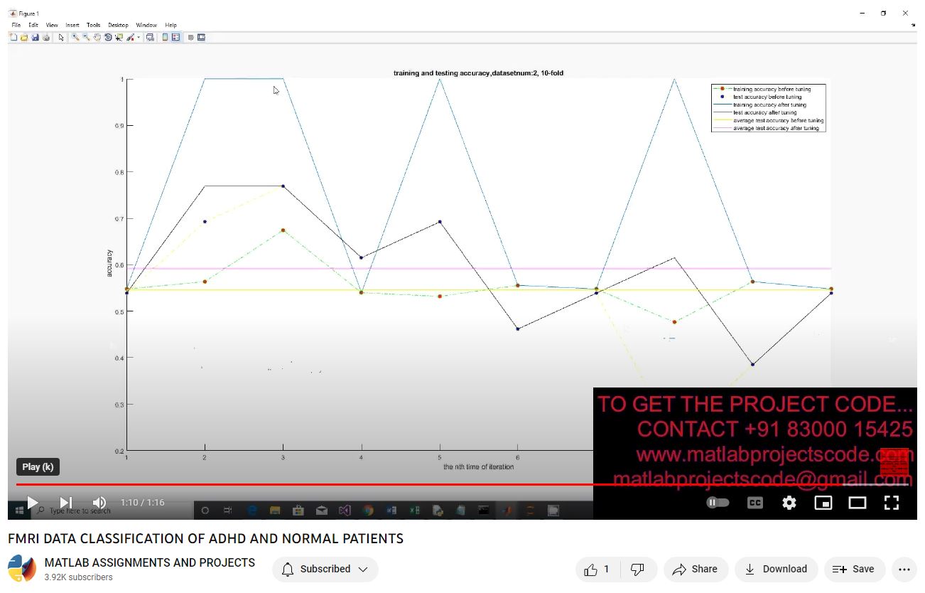 Fmri Data Classification Of Adhd And Normal Patients project thumbnail image