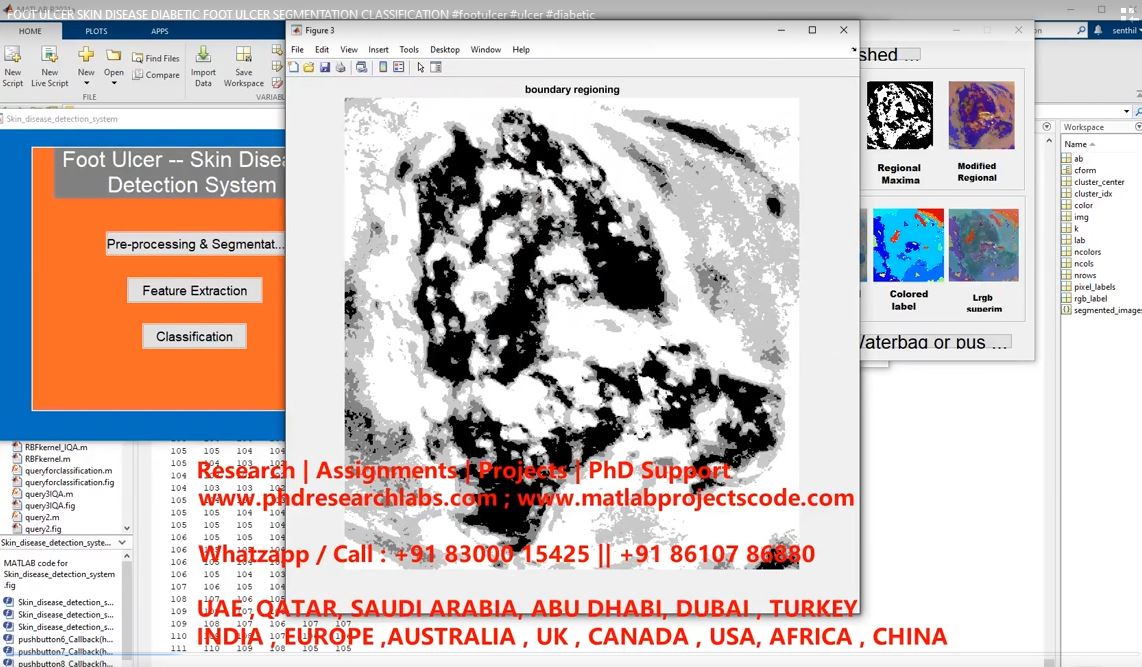 Foot Ulcer Skin Disease Diabetic Foot Ulcer Segmentation Classification project thumbnail image
