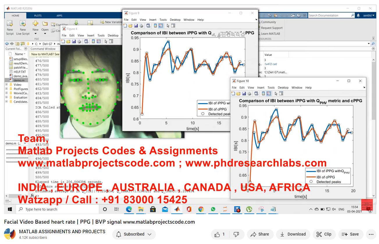 Facial Video Based Heart Rate _ Ppg _ Bvp Signal project thumbnail image