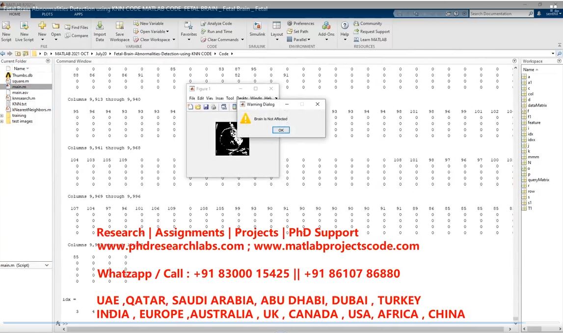 Fetal Brain Abnormalities Detection Using Knn Code Matlab Code Fetal Brain _ Fetal Brain _ Fetal project thumbnail image