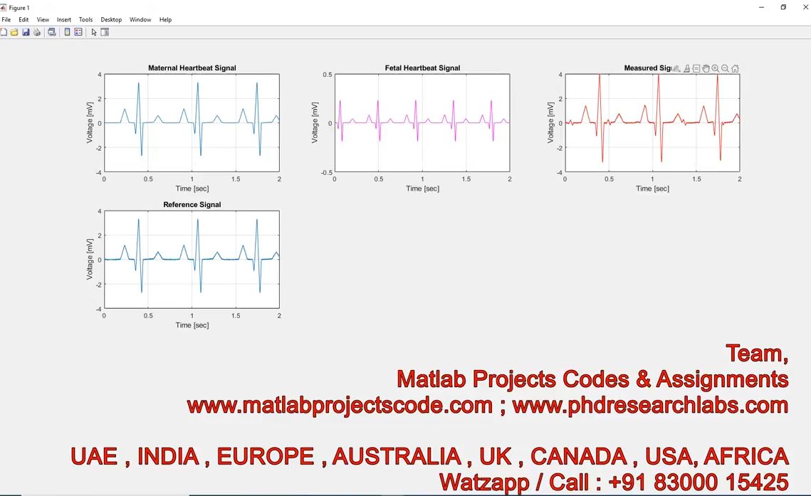 Fetal Ecg Extraction Simulink Model - Fecg - Fetal Ecg - Matlab - Ecg - Simulink project thumbnail image